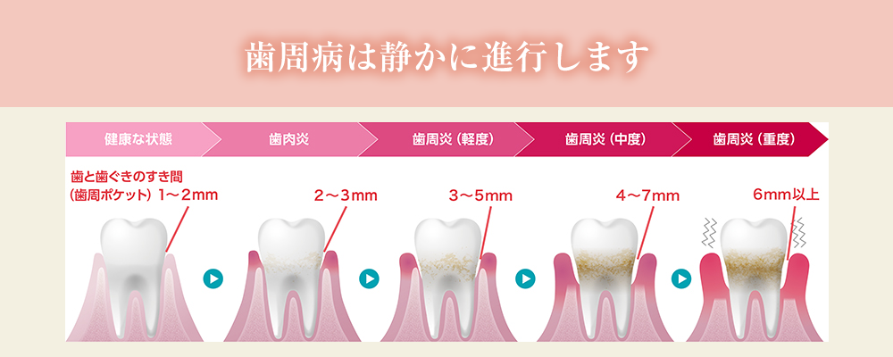 歯周病治療｜いしはら歯科クリニック