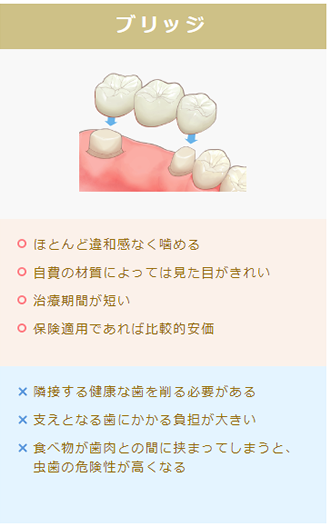 インプラント治療｜いしはら歯科クリニック