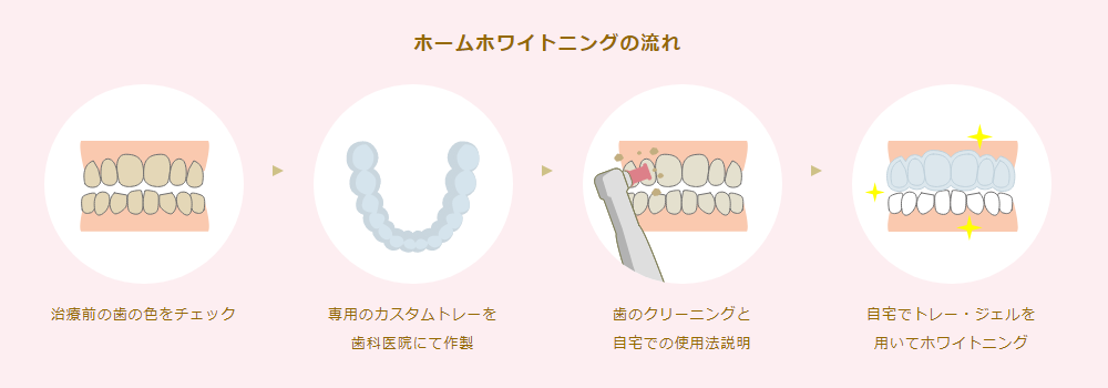 ホームホワイトニング｜いしはら歯科クリニック